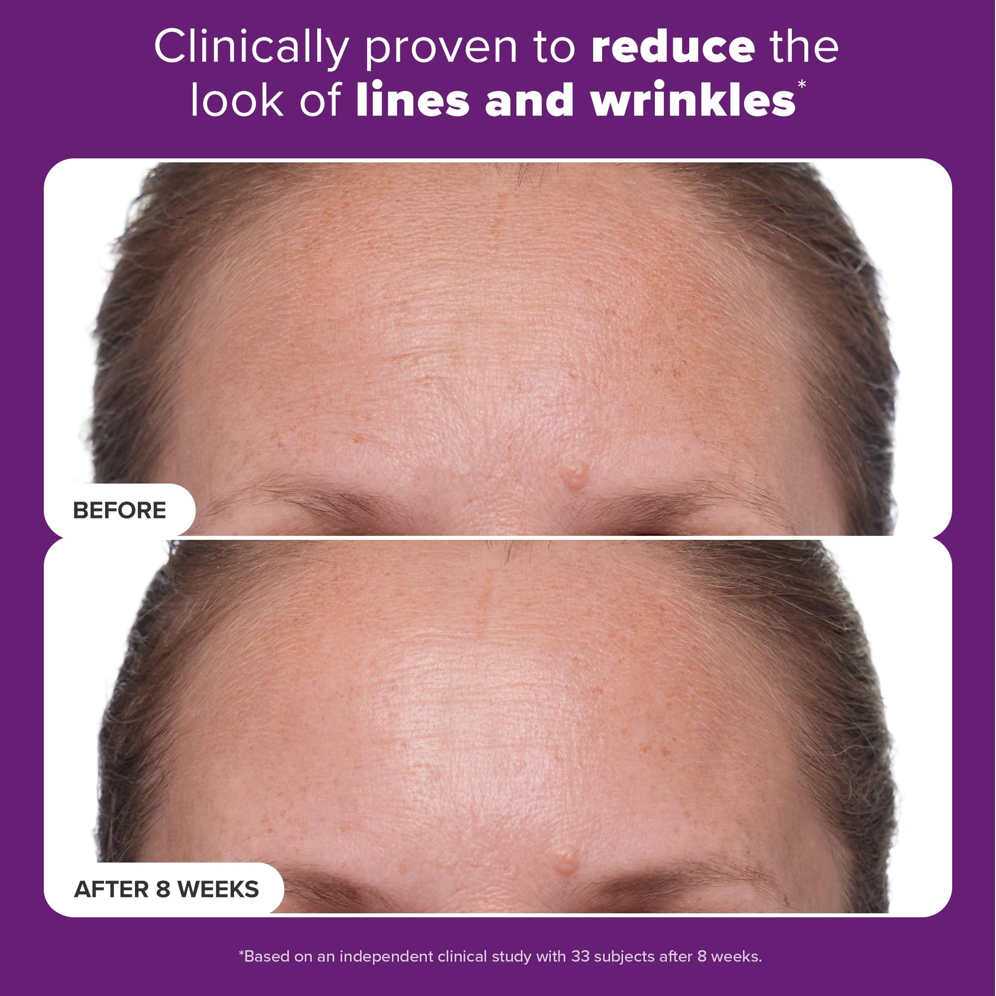 Paula's Choice CLINICAL 1% Retinol Treatment Cream