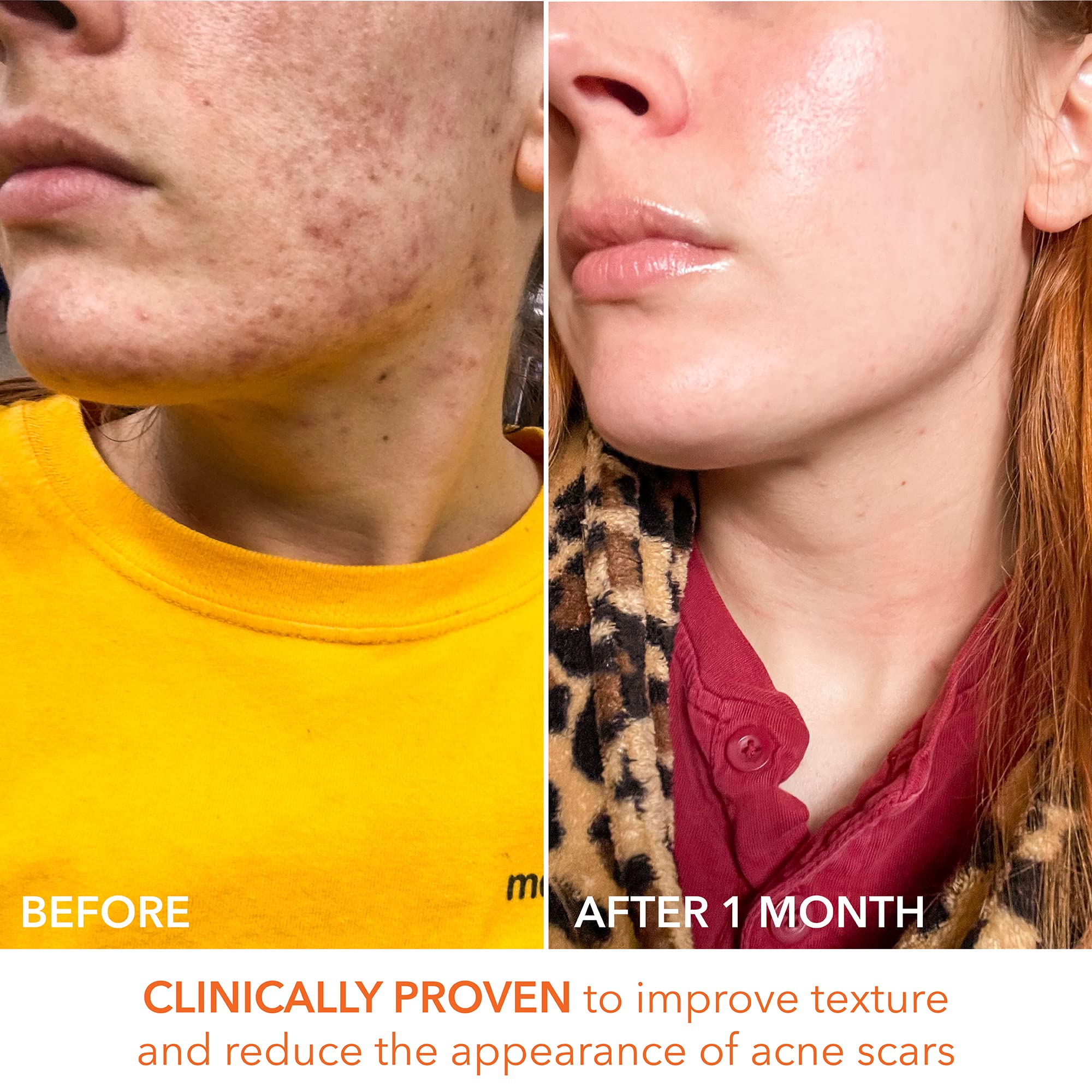 Dr Dennis Gross Alpha Beta Universal Daily Peel