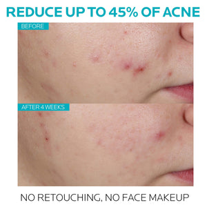 La Roche-Posay Effaclar Salicylic Acid Treatment
