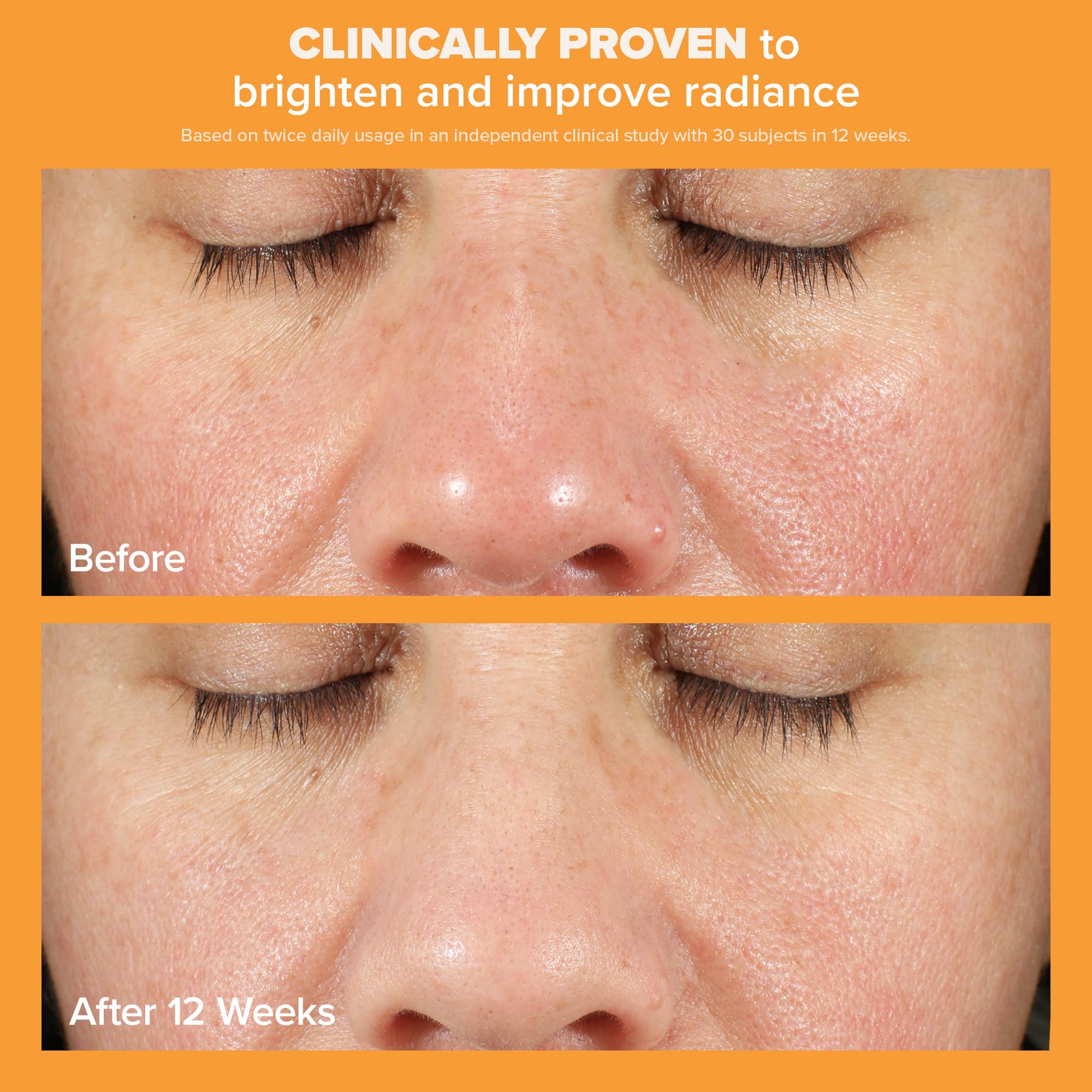 Paula's Choice BOOST Skin Brightening Serum