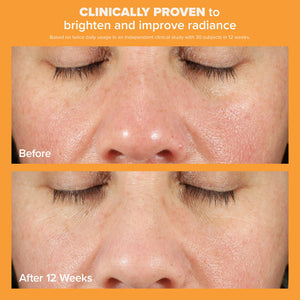 Paula's Choice BOOST Skin Brightening Serum