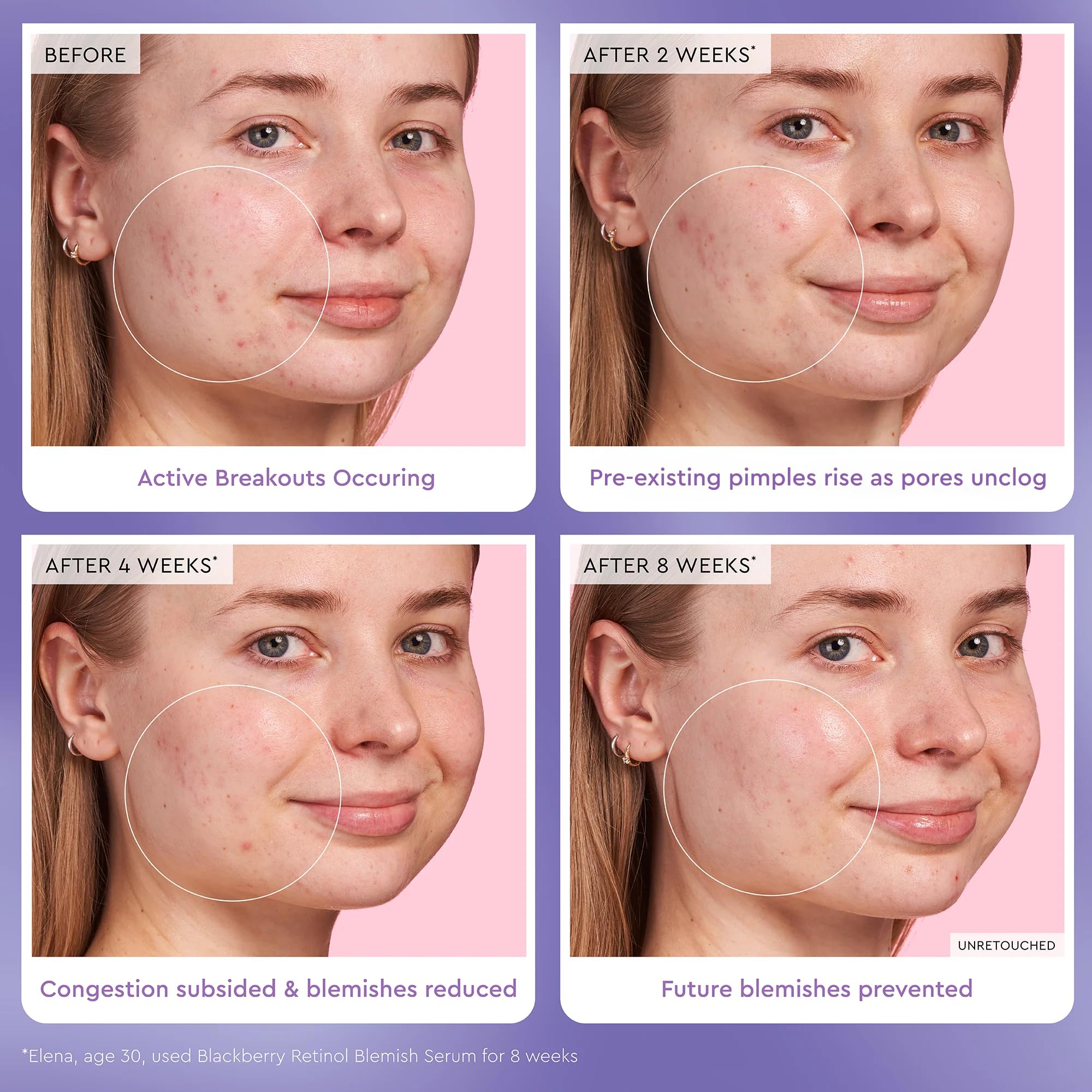 Glow Recipe Gentle Blackberry Retinol Night Serum