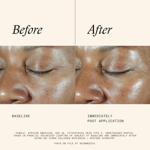 SkinMedica HA5 Hydra Collagen Replenish + Restore Hydrator