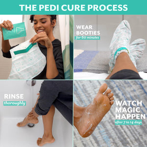 Patchology PoshPeel Pedi Cure - Foot Peel Mask Soak Treatment