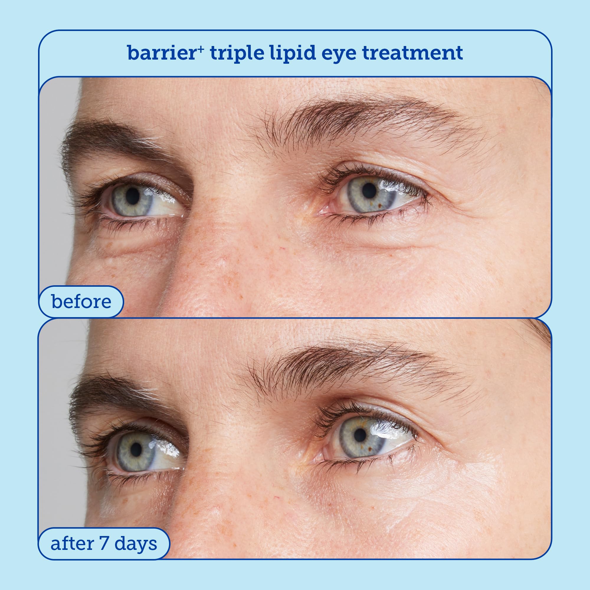 Skinfix Barrier+ Firm Trio