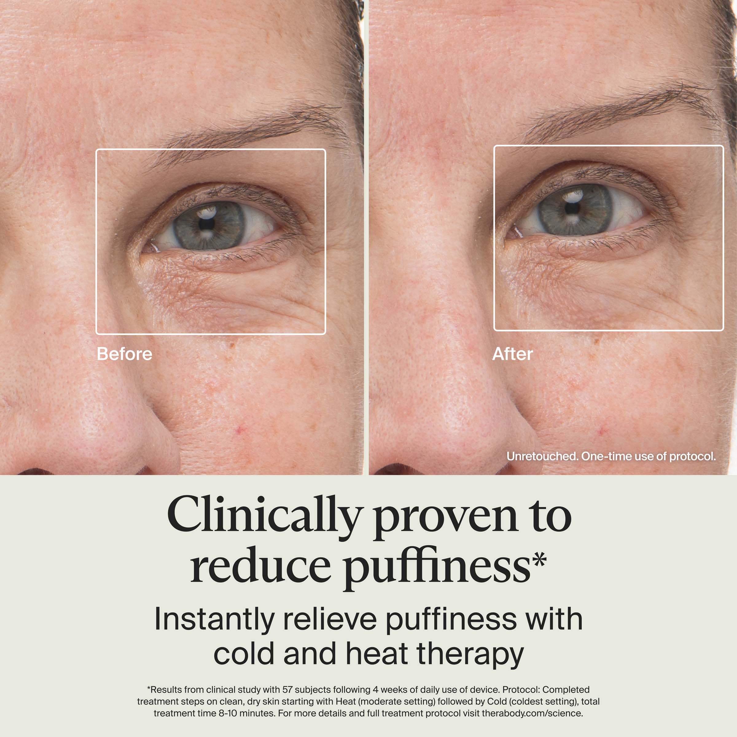 Therabody TheraFace Depuffing Wand – Cold and Heat Skincare Treatment