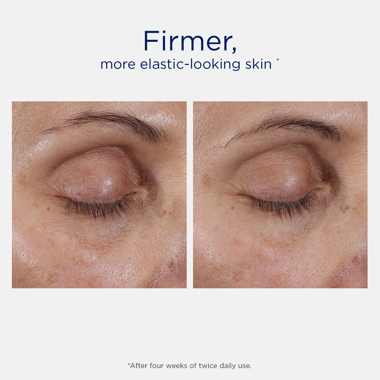 NEOSTRATA SKIN ACTIVE Intensive Eye Therapy