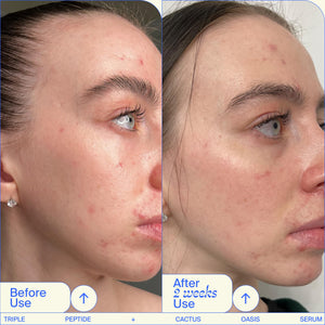 Youth To The People Facial Serum Trio