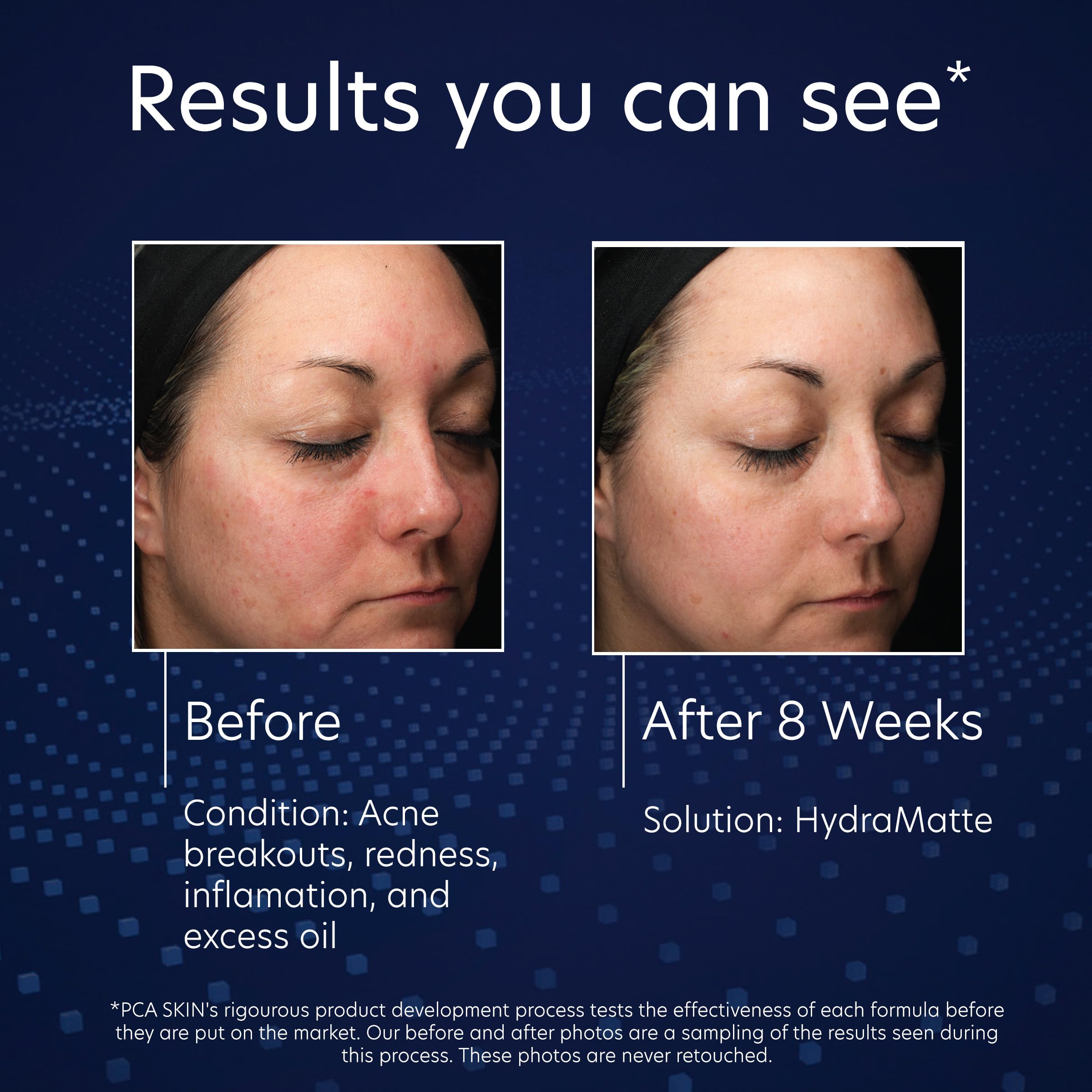 PCA SKIN HydraMatte Oil Control Moisturizer