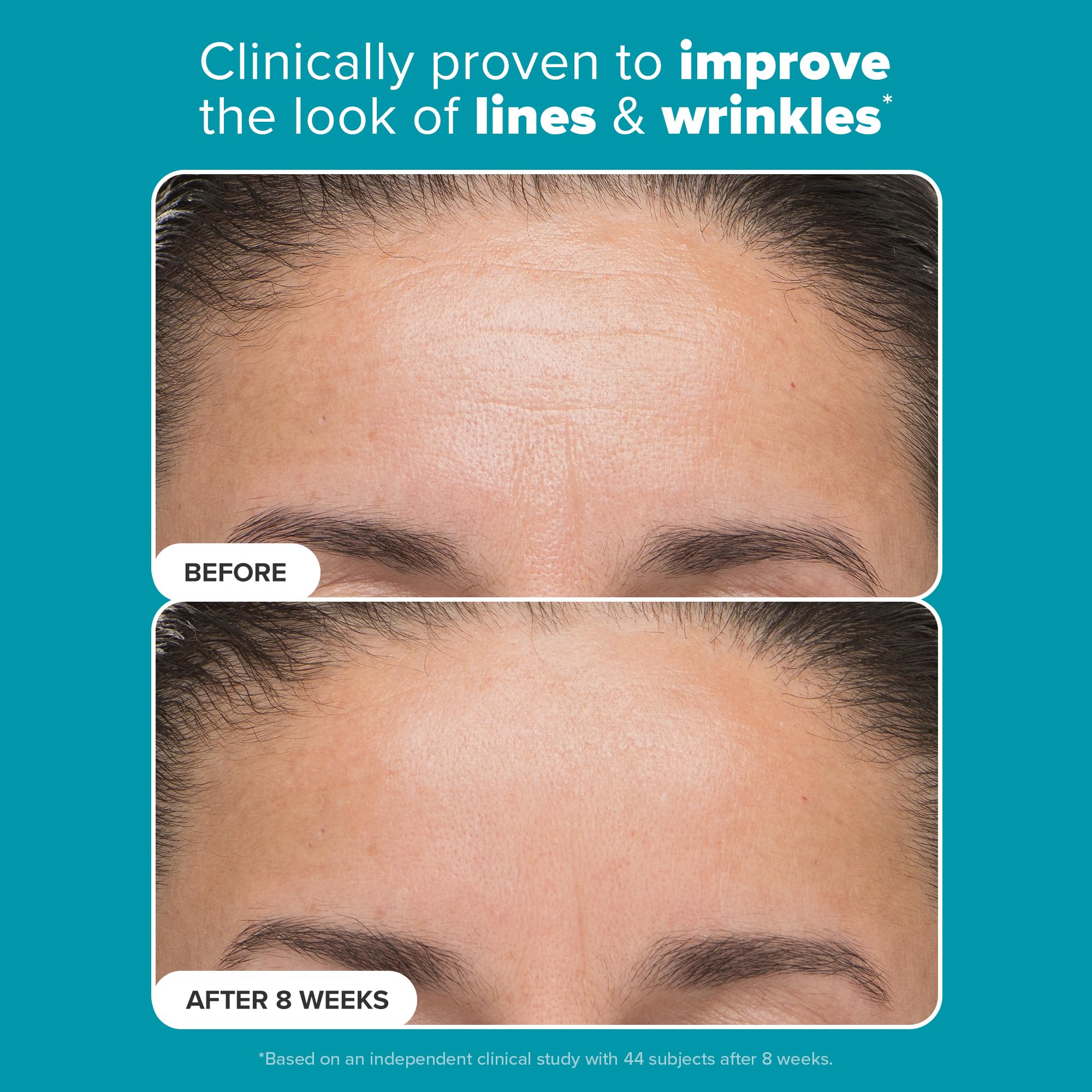 Paula’s Choice 6% Mandelic Acid + 2% Lactic Acid Exfoliant