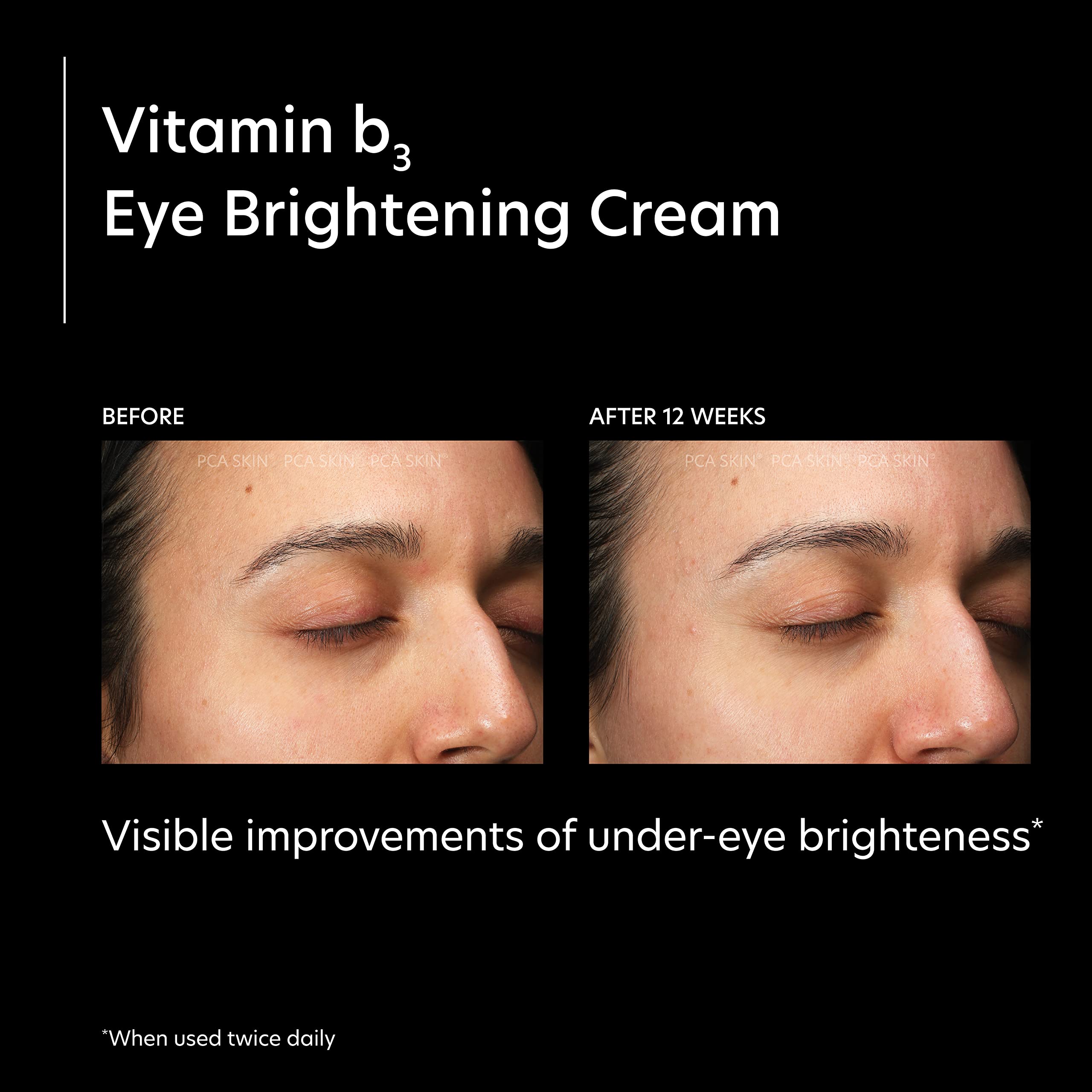 PCA SKIN Vitamin B3 Eye Brightening Cream