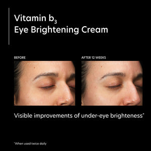 PCA SKIN Vitamin B3 Eye Brightening Cream