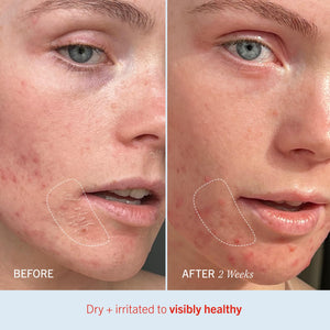 First Aid Beauty - Ultra Repair Cream