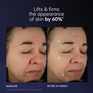 PCA SKIN Pro Max Age Renewal Anti Aging Serum