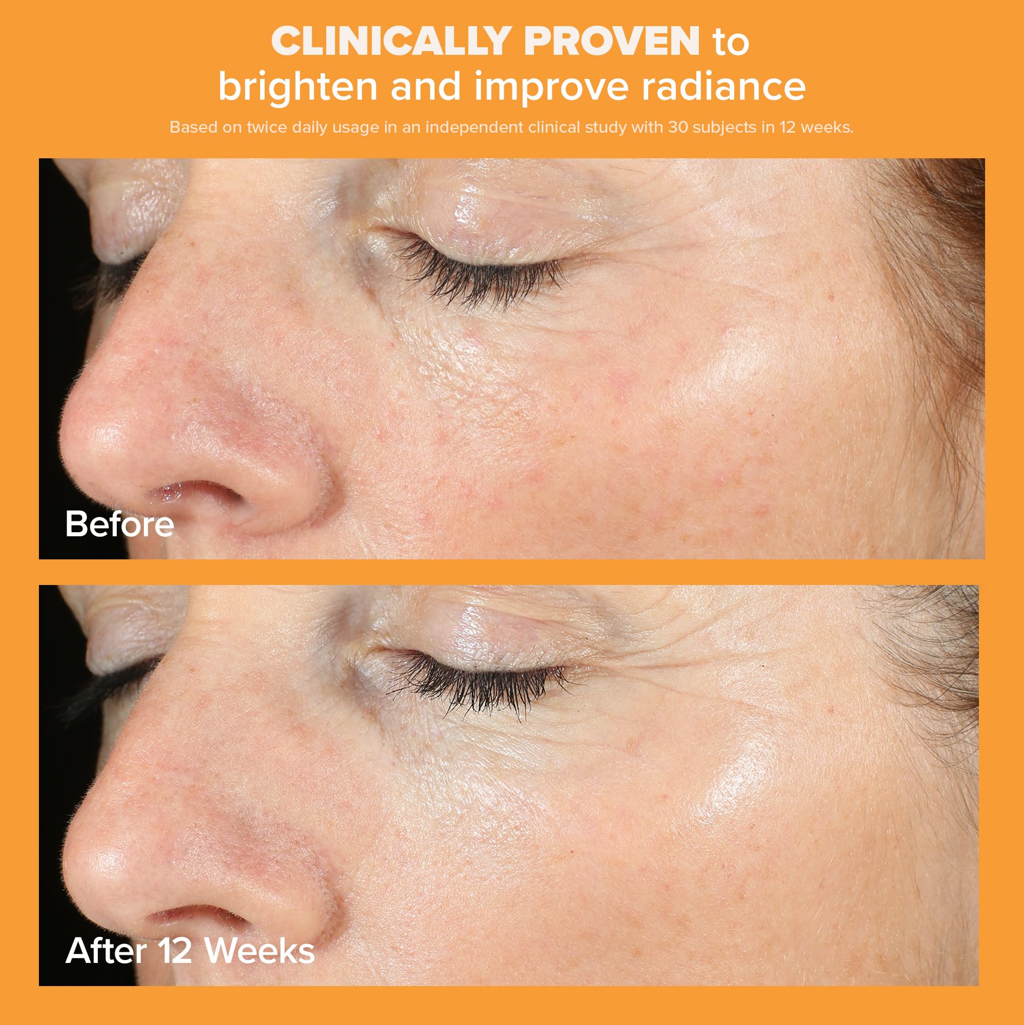 Paula's Choice BOOST Skin Brightening Serum