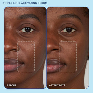 Skinfix Triple Lipid Activating Serum