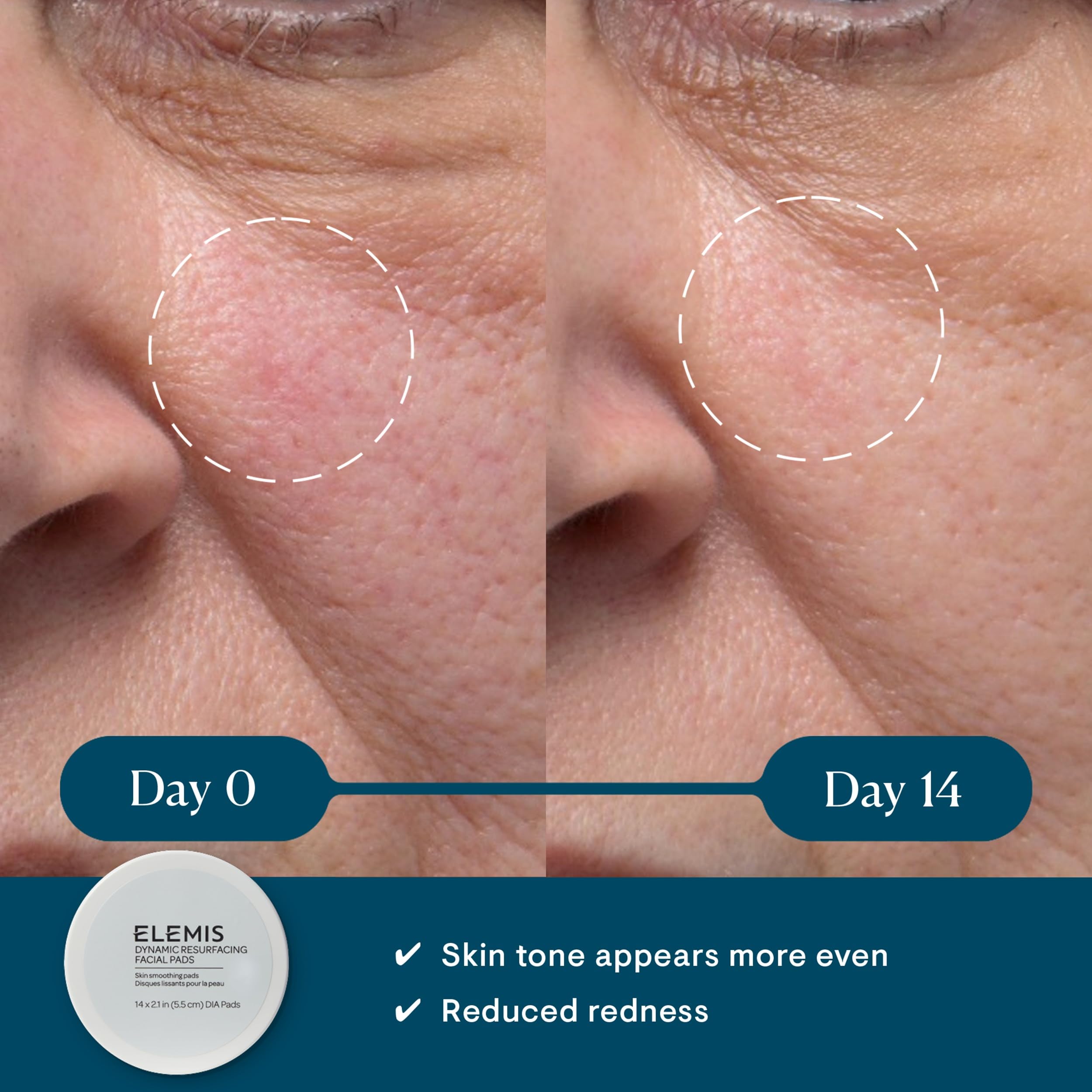 ELEMIS Dynamic Resurfacing Facial Pads