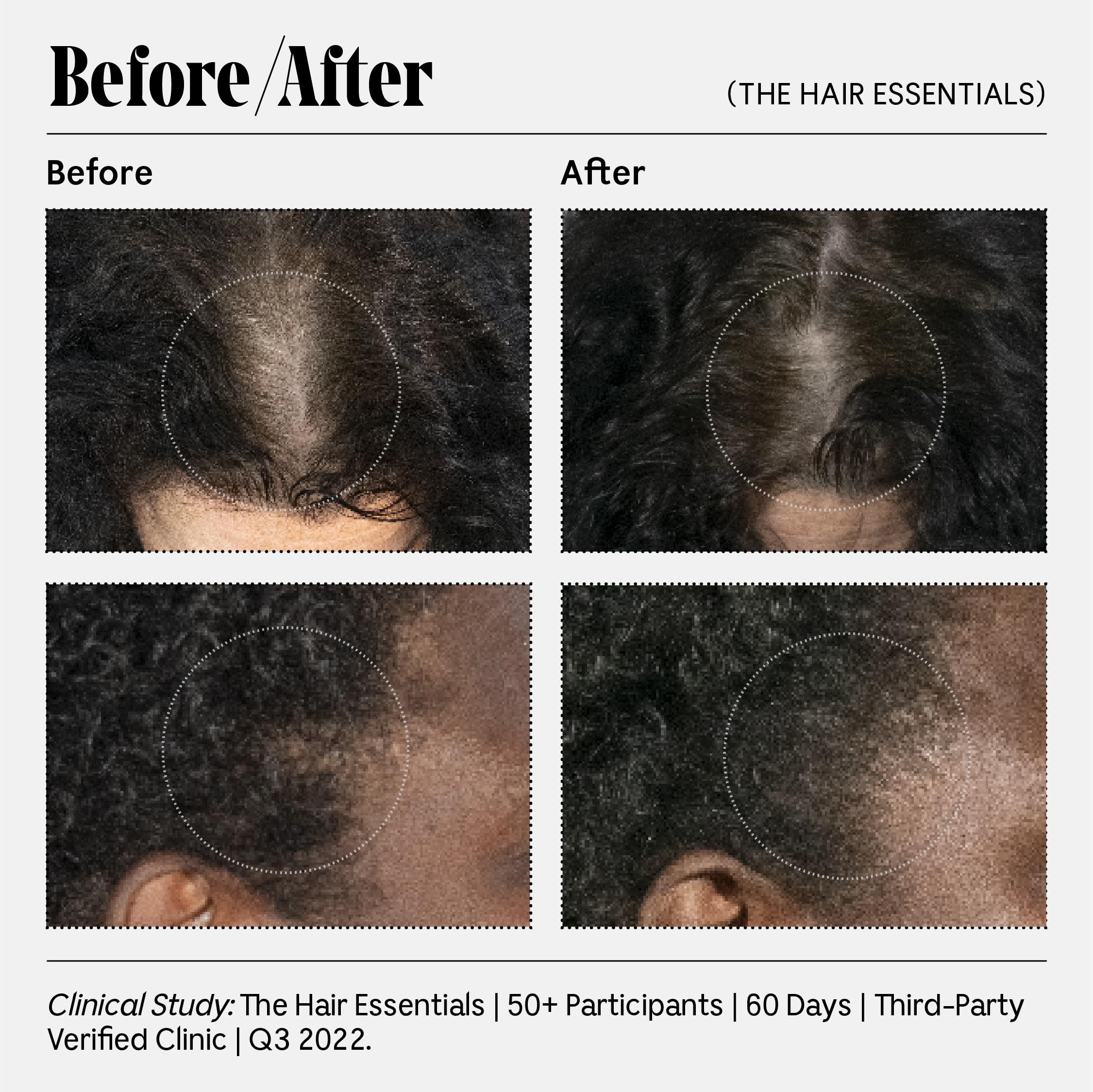 Nécessaire The Conditioner. Hyaluronic Acid + Vitamin B Complex