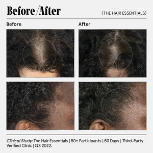 Nécessaire The Conditioner. Hyaluronic Acid + Vitamin B Complex