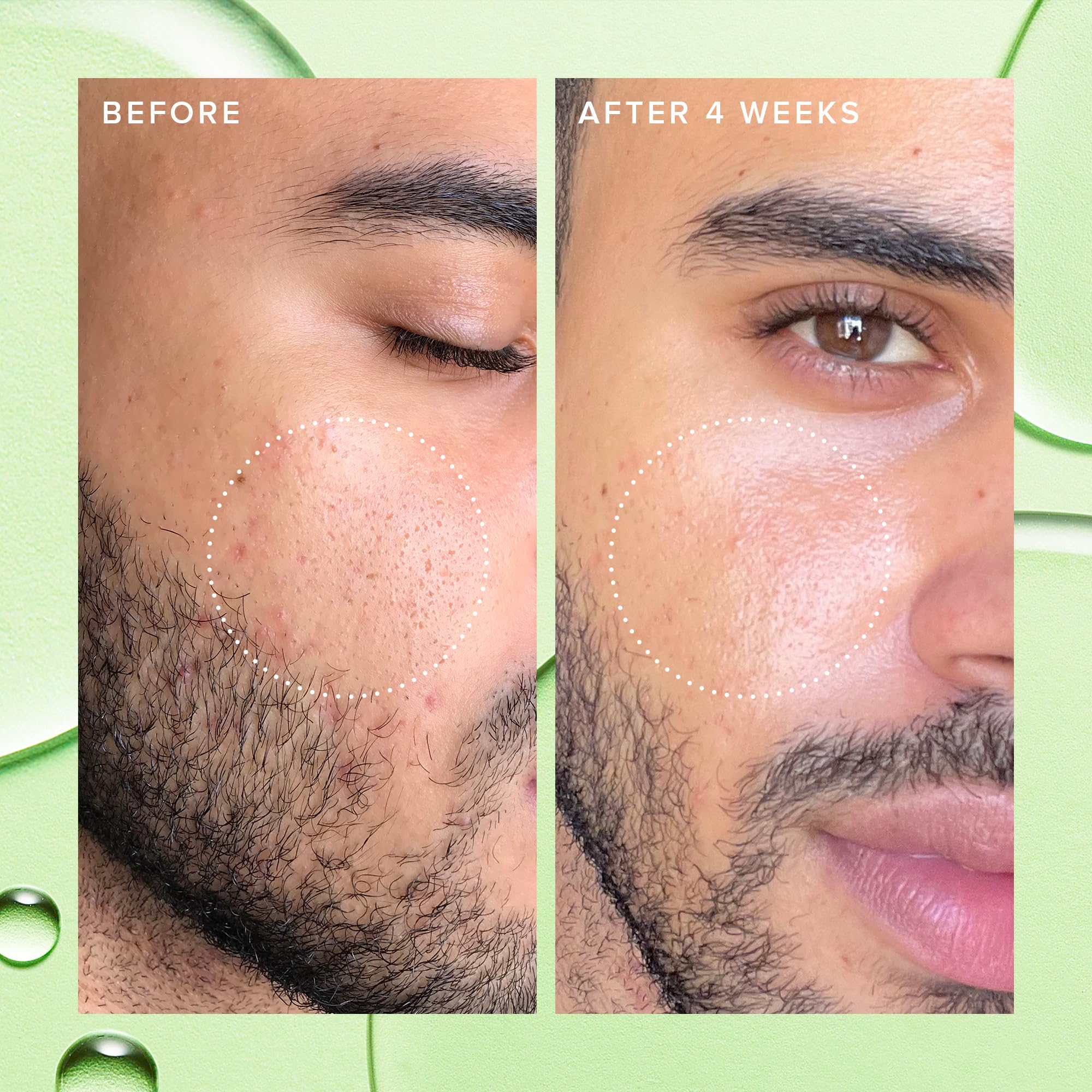 Farmacy 2% Salicylic Acid Toner