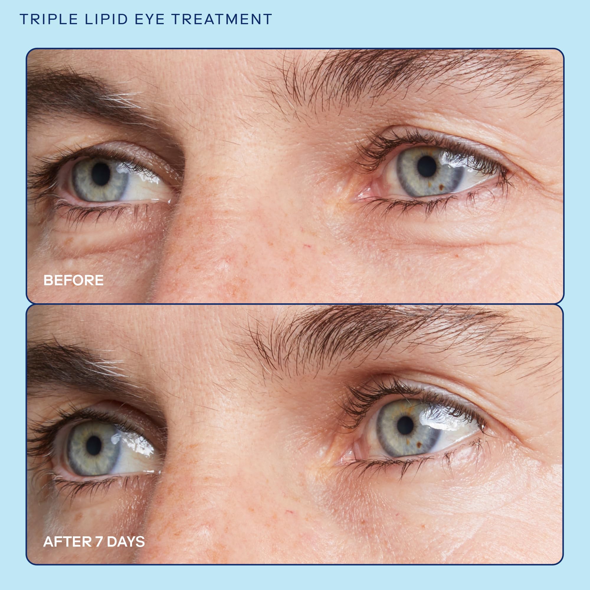 Skinfix Barrier+ Triple Lipid Eye Treatment