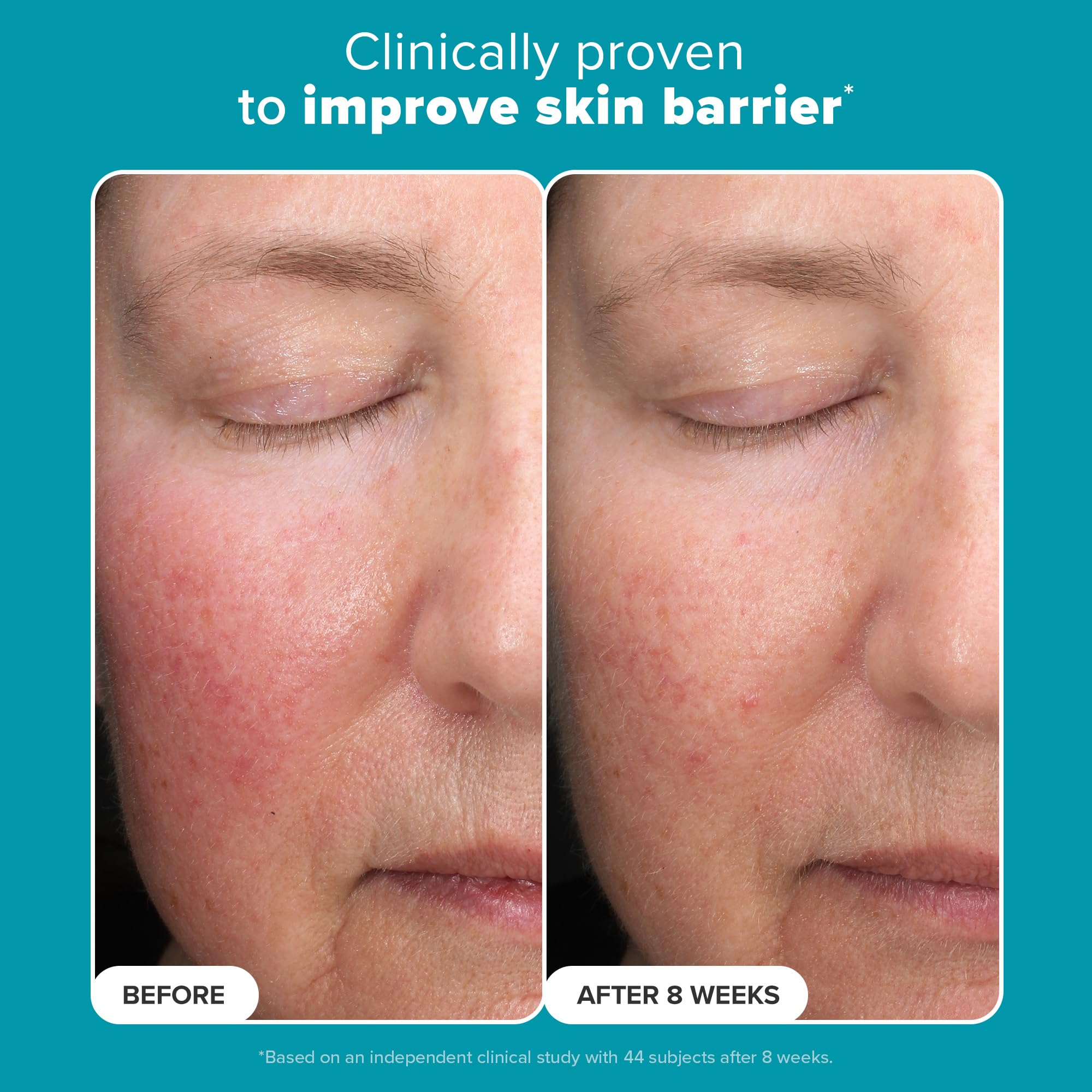 Paula’s Choice 6% Mandelic Acid + 2% Lactic Acid Exfoliant