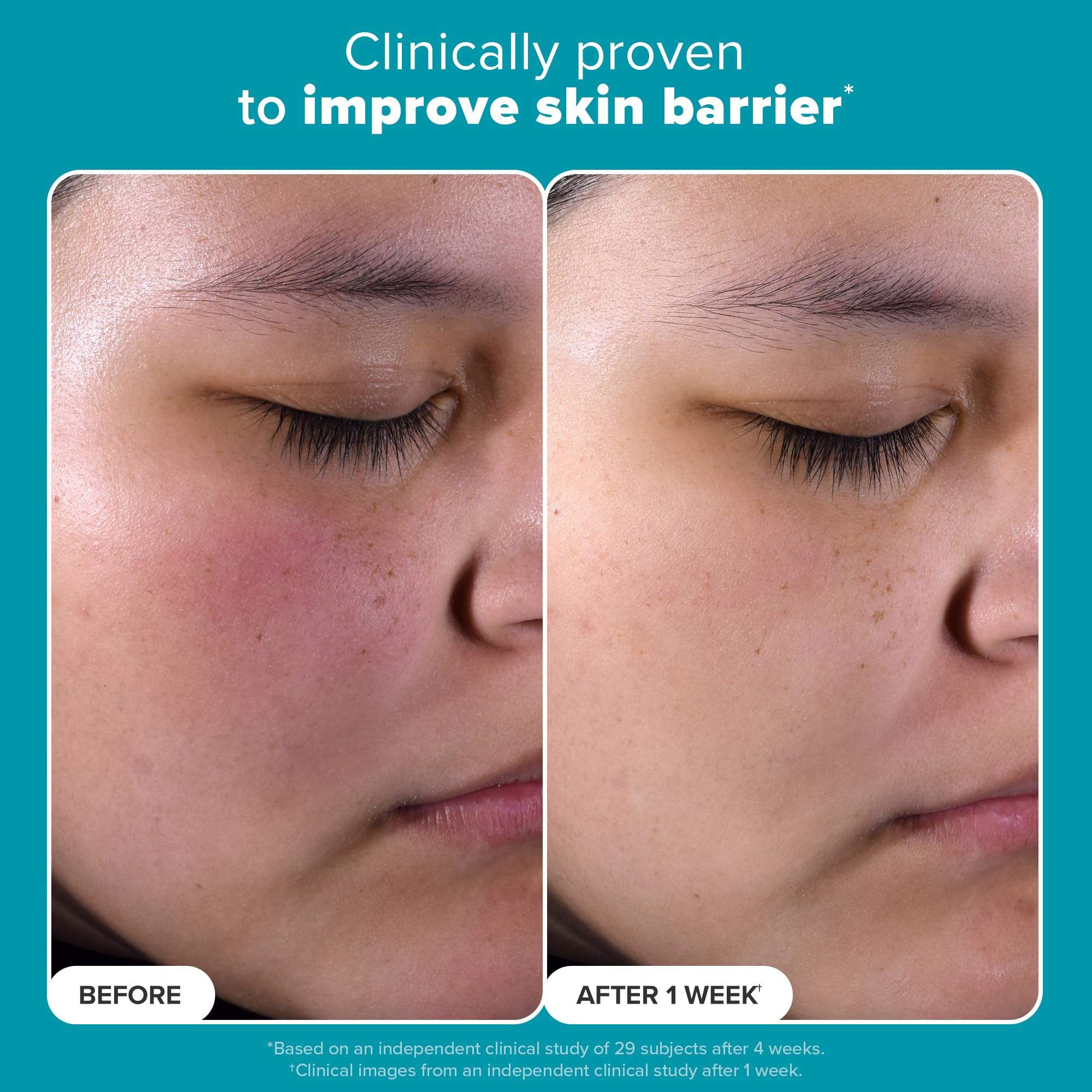 Paulas Choice--SKIN PERFECTING 2% BHA Liquid Salicylic Acid Exfoliant