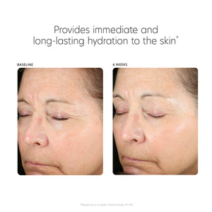 PCA SKIN Hyaluronic Acid Boosting Face Serum