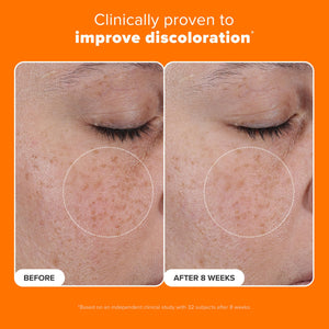 Paula’s Choice 25% Vitamin C Serum