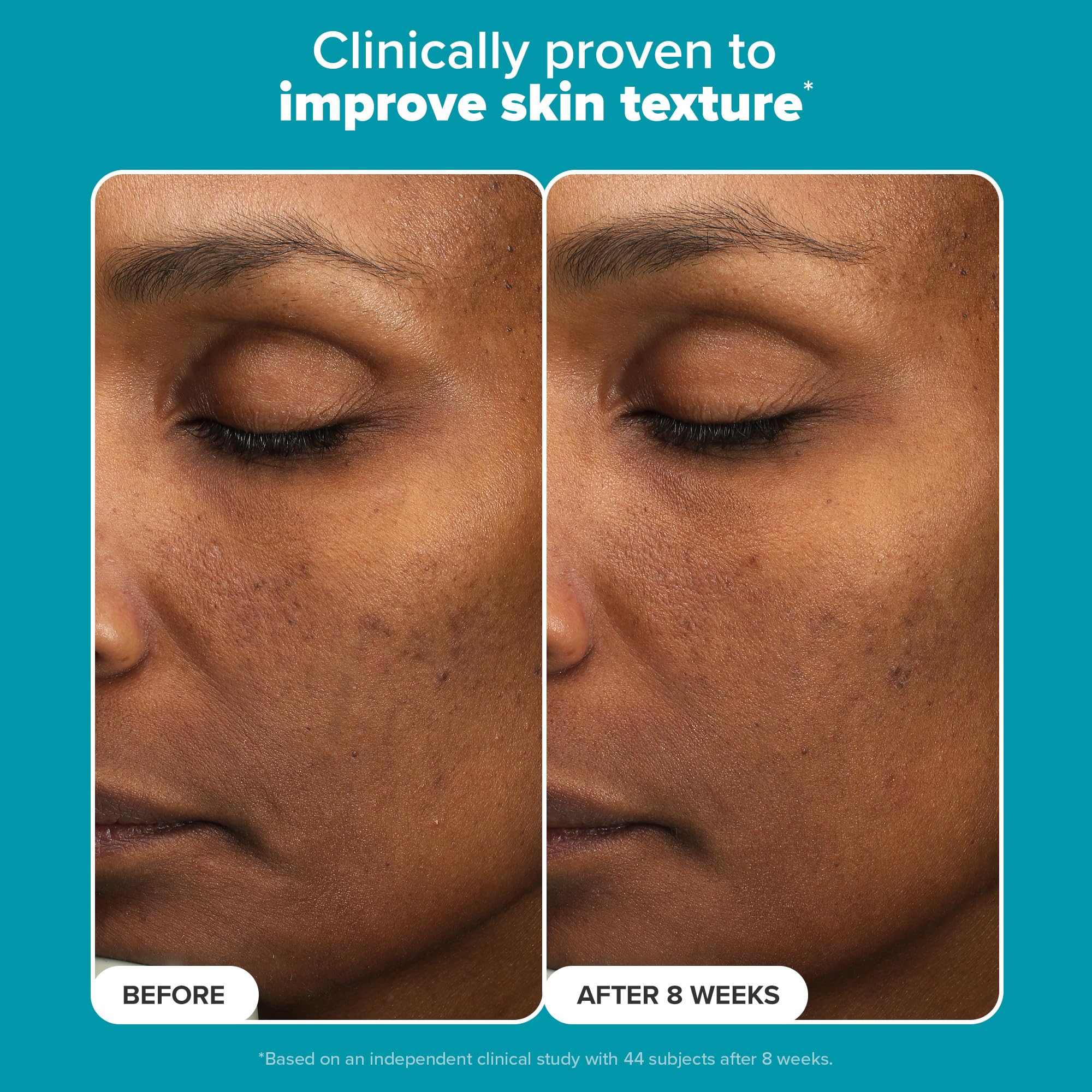 Paula’s Choice 6% Mandelic Acid + 2% Lactic Acid Exfoliant