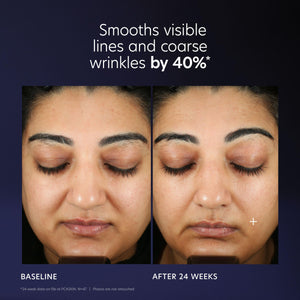 PCA SKIN Pro Max Age Renewal Anti Aging Serum