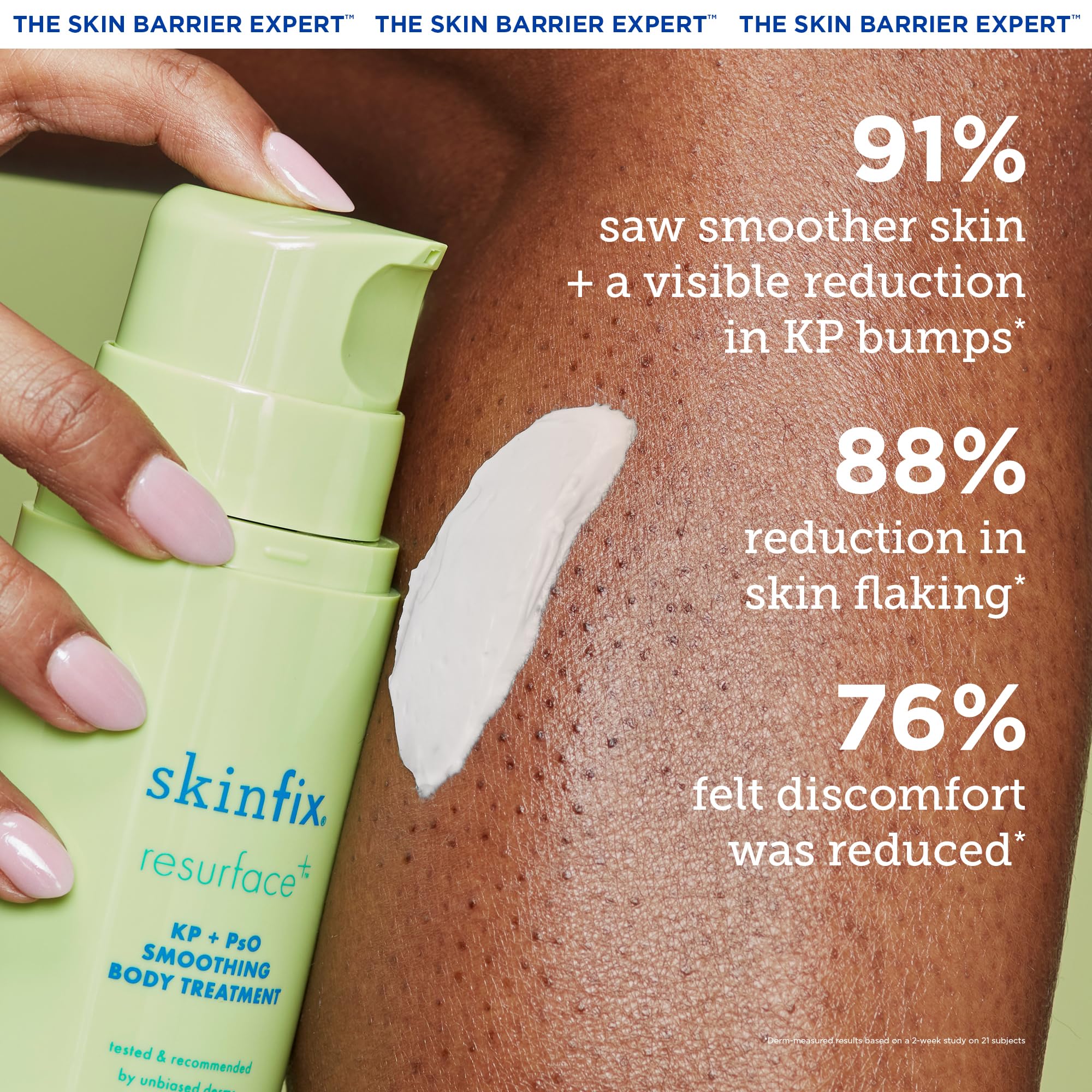 Skinfix KP+ Psoriasis Smoothing Treatment Body Lotion