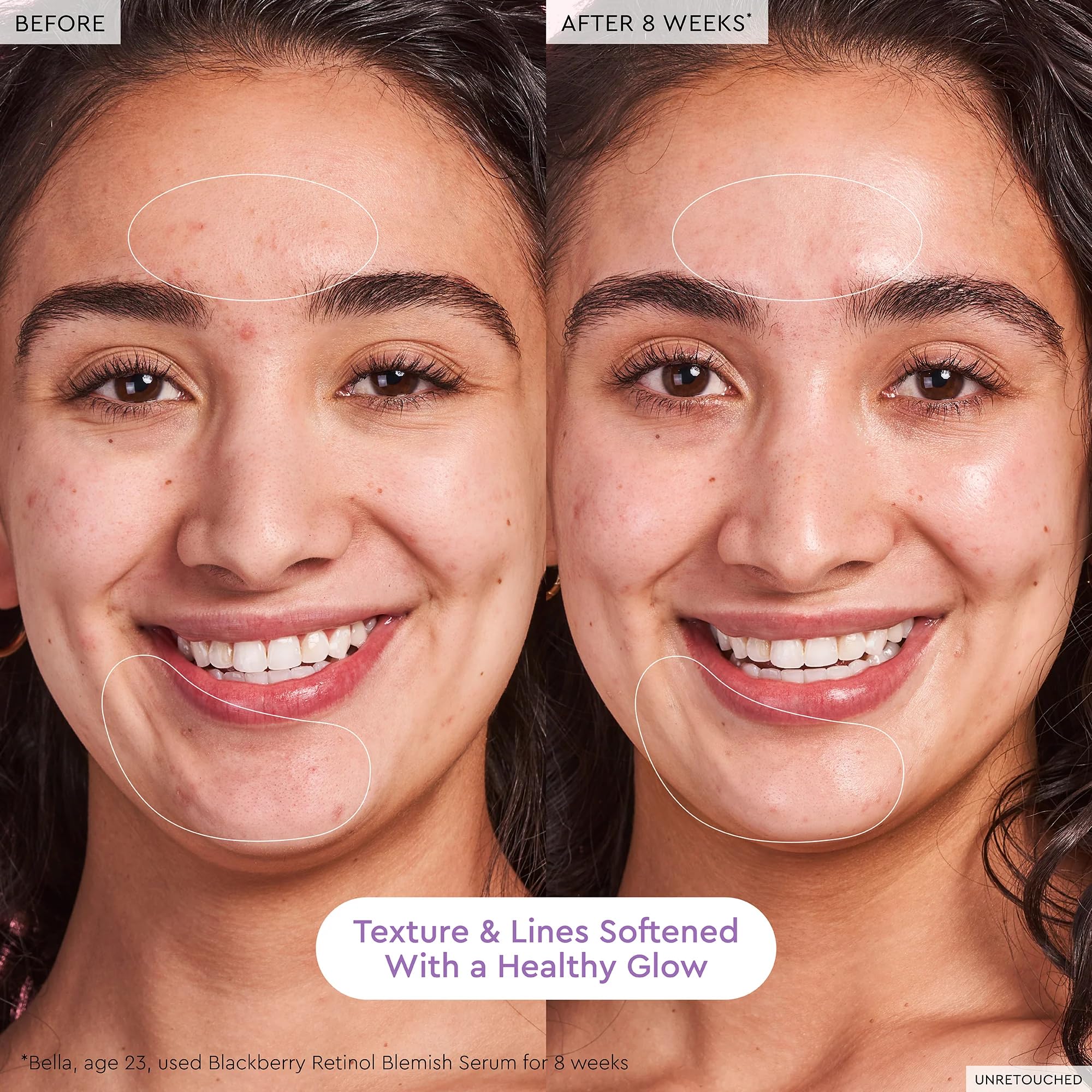 Glow Recipe Gentle Blackberry Retinol Night Serum