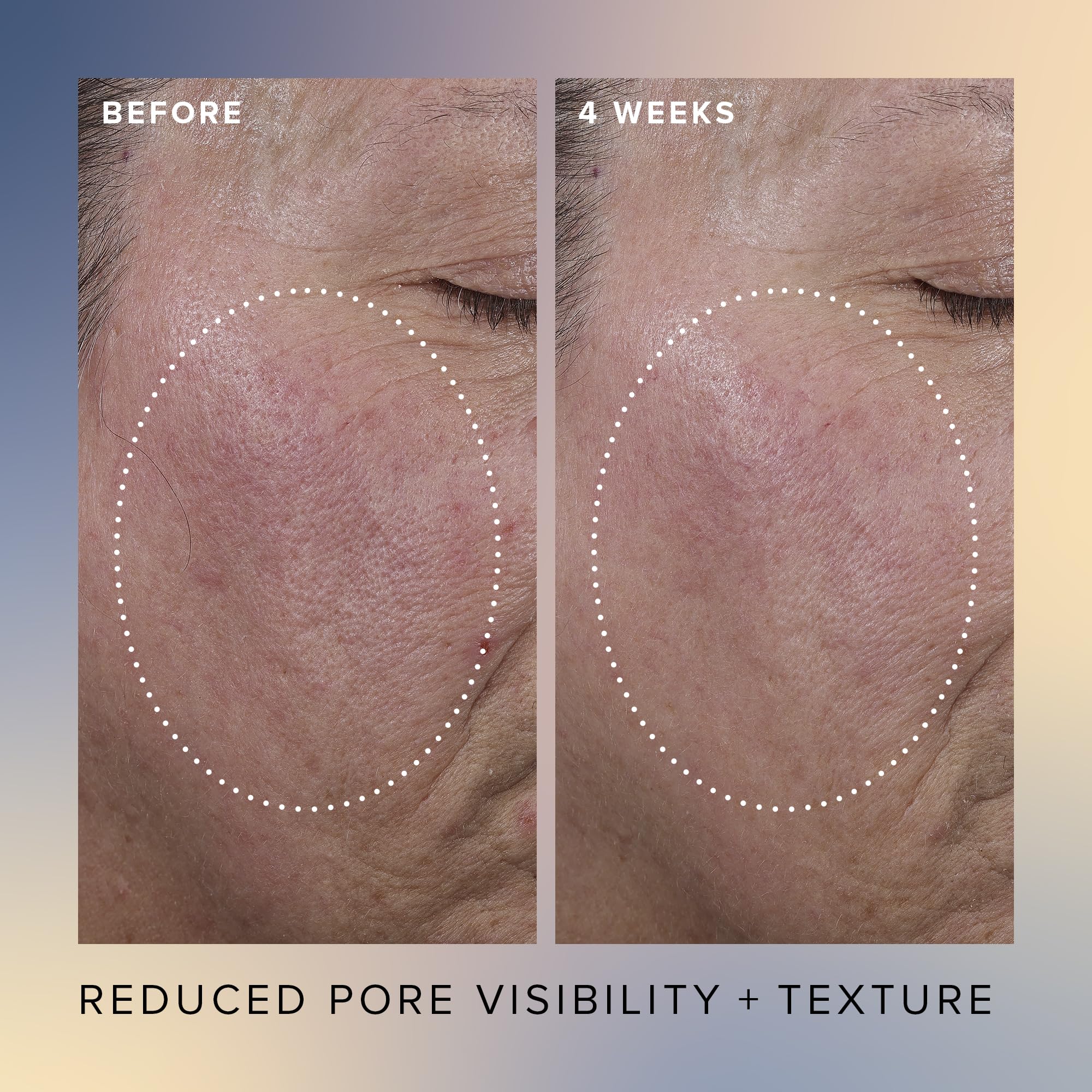 Farmacy Face Exfoliator Serum