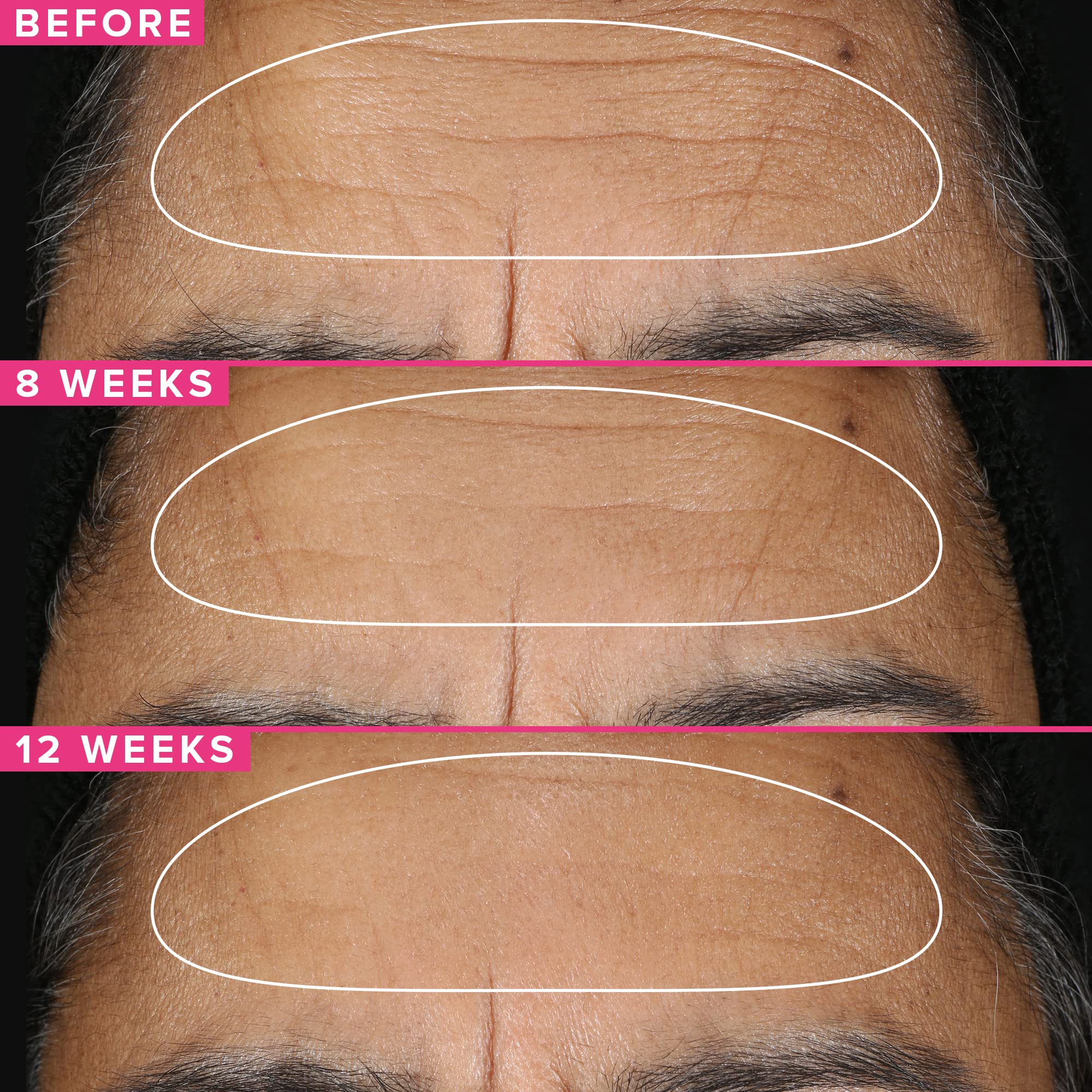 Farmacy Retinol Serum for Face